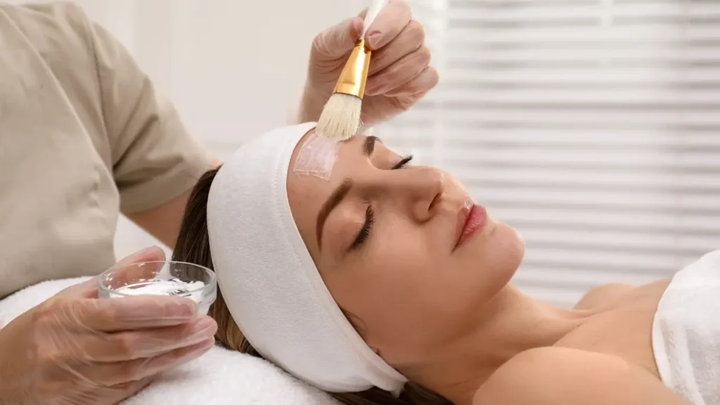 chemical peel