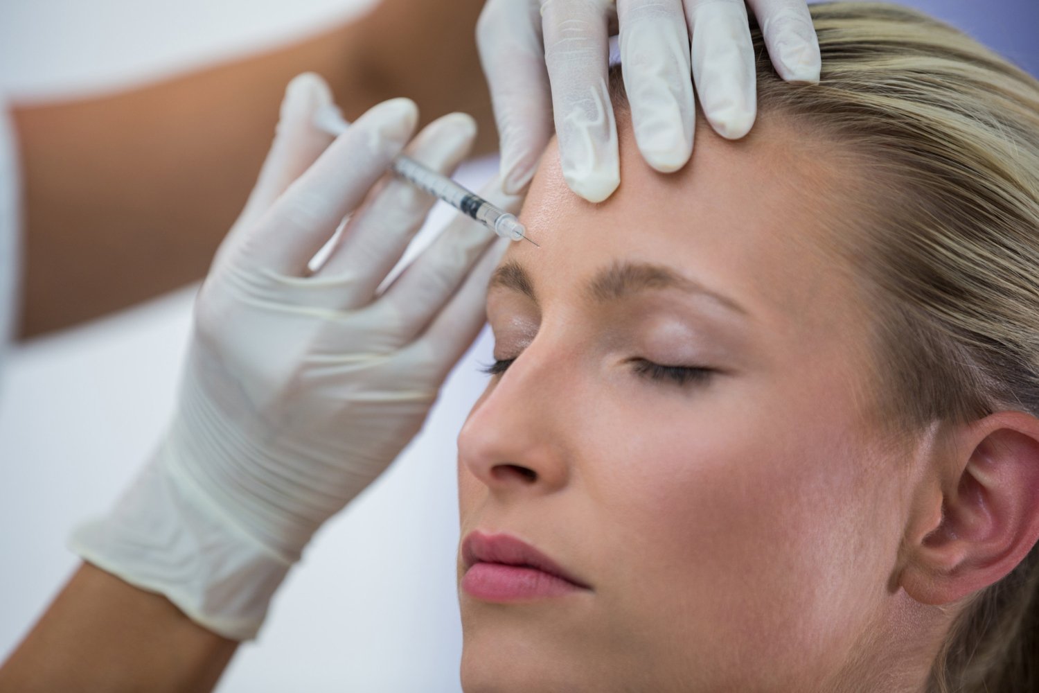 Injectables and microneedling
