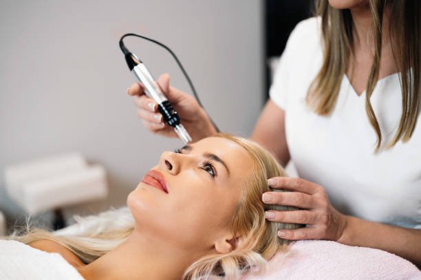 Microneedling