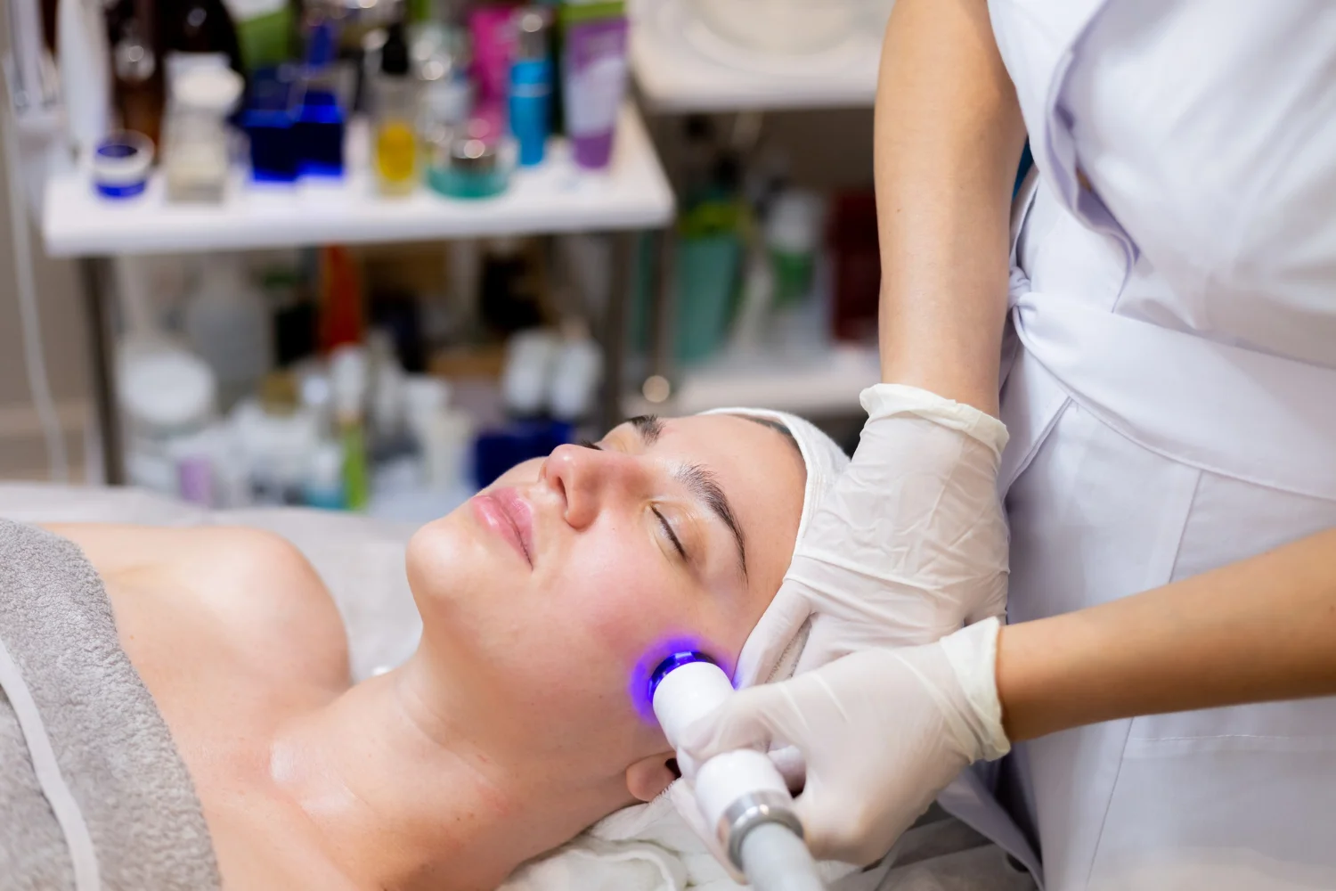 How Laser Acne Treatment Helps Achieve Long-Lasting Clear Skin
